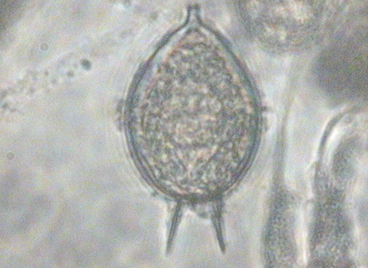 Dictyocha speculum